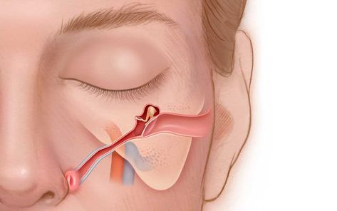 Eustachian Tube Dysfunction, Ear Congestion, Ear Tubes, Soft Palate, Acupressure Therapy, Basic Anatomy And Physiology, Middle Ear, Medical Posters, Lymph Drainage