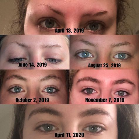 Thick Eyebrows Natural, Growing Out Eyebrows, Grow Eyebrows Faster, Regrow Eyebrows, Brow Hacks, Eyebrow Hair Growth, Long Eyebrows, Big Eyebrows, Sunburn Peeling