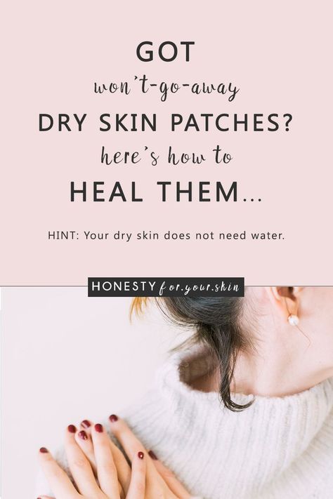 Dry skin patches are oh so irritating... especially when they happen on your face. They look flaky, red and can be sensitive. They can suck your confidence. Clump your foundation. Be painful, itchy and ageing. Dry skin patches are a sign your skin health is low. Do nothing and your dry skin patches will get worse. Choose to take action and your skin health battery can be happily topped back to full. Want to know how? Come learn all my friend... Flaky Skin On Face, Patchy Skin, Dry Flaky Skin, Dry Skin On Face, Dry Skin Remedies, Skin Balm, Skin Patches, Dry Skin Patches, Dry Face