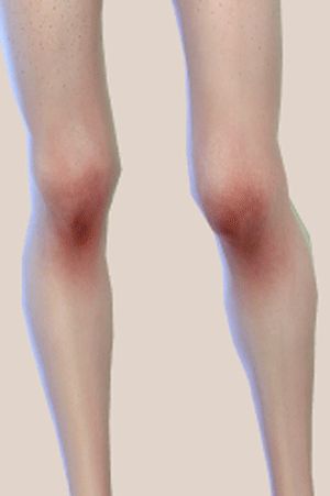 The Sims 4 Cc Bruising, Sims 4 Cc Doll Joints, Sims 4 Knee Blush, Sims 4 Lip Scar, Sims 4 Cc Top Surgery Scars, Veins Cc Sims 4, Sims 4 Cc Body Wounds, Scar Cc Sims 4, Sims 4 Shoulder Slider