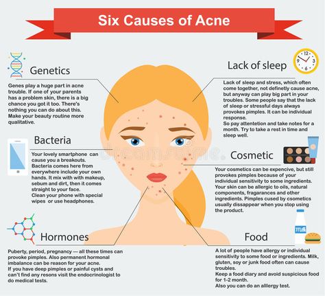 Causes Of Acne, Acne Hacks, Ac New Leaf, Health Hacks, Acne Causes, Acne Problem, Acne Scar Removal, Neem Oil, Skin Remedies