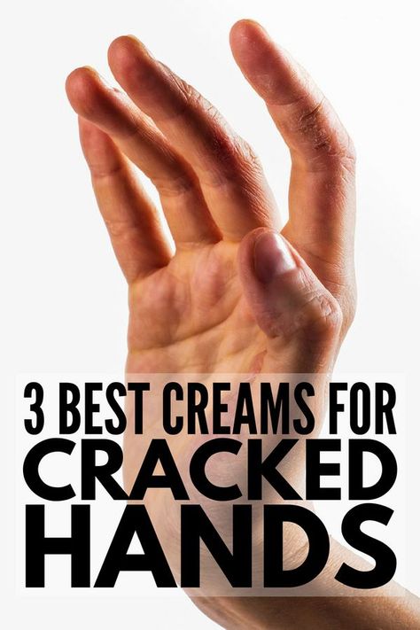 Cracked Fingers, Extremely Dry Hands, Wedding Acrylic Nails, Dry Cracked Hands, Types Of Texture, Cracked Hands, Aloe Vera Face Mask, Fall Makeup Looks, Diy Remedies