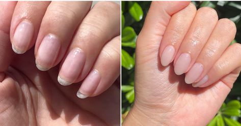 Our editor tries out the expert recommended trend, "nail cycling." See before and after photos here. Opi Nail Envy, Nail Serum, Popsugar Beauty, Nail Cuticle, Nail Envy, Nail Strengthener, Nail Health, Opi Nails, After Photos