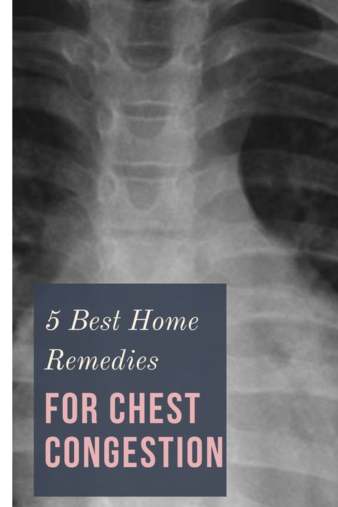 The following home remedies including OTC drug Ascoril have been found to provide fast and effective relief to most people suffering from chest congestion. Learn more. #homeremedies #chestcongestion #whattodowithchestcongestions #naturalremediesforchestcongestions #mamabee Home Remedy For Chest Congestion, Remedy For Chest Congestion, Chest Infection Remedies, Chest Congestion Relief, Remedies For Chest Congestion, Chest Congestion Remedies, Congestion Relief, Chest Congestion, Healthy Ideas