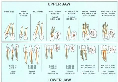 Endo access Dental Assistant Study Guide, Dental Charting, Dental Assistant Study, Dental Posters, Kedokteran Gigi, Dentistry Student, Dental Anatomy, Restorative Dentistry, Dental Art