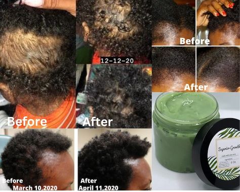 Superiorgrowthgrease - Etsy Hair Growth Grease, Grease Hair, Aloe Vera Hair, Hair Grease, Thicker Stronger Hair, Hair Moisturizer, Make Hair Thicker, Grease Hairstyles, Extreme Hair Growth