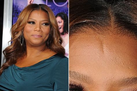 Queen Latifah has 2-inch forehead scar. She got it tripping during a childhood game of tag and hitting her head. She says she'd never cover it up because it gives her face character. Forehead Scar, Wedding Makeup Bride, Glam Wedding Makeup, Mole Removal, Queen Latifah, Face Characters, Got It, More Photos, Wedding Makeup