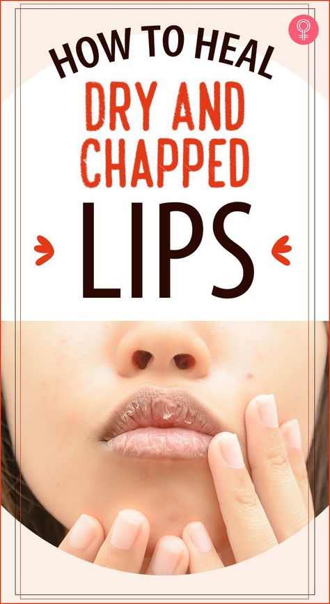 How To Heal Dry And Chapped Lips: And guess what, we are capable of damaging their protective cover by simply licking them (you didn’t know that, did you?). We’ve put together a few ways that could help keep our smile beautiful always. Let’s take a look. #skincare #skincaretips #lipcare Dry Lips Remedy, Chapped Lips Remedy, Remedies For Dry Mouth, Sore Lips, Dry Cracked Lips, Acne Free Skin, Lip Care Routine, Lip Primer, Cracked Lips