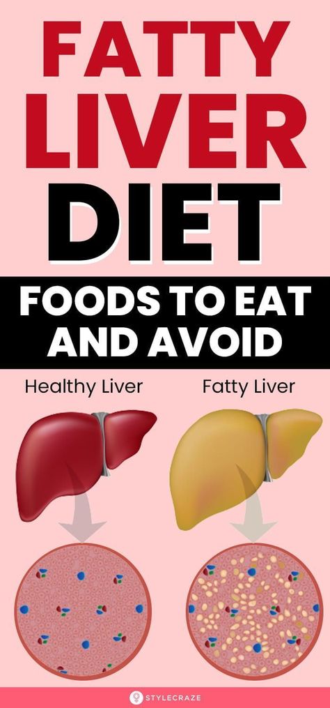 Liver Diet Plan, 1200 Calorie Diet Meal Plans, Healthy Liver Diet, Body Functions, Kidney Detox, Liver Diet, Liver Detox, Healthy Liver, Low Fat Diets