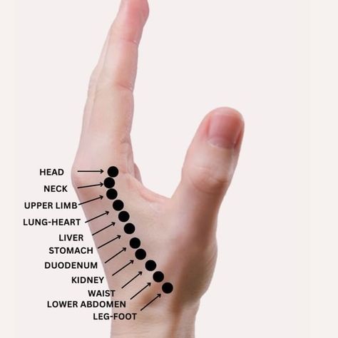 Dr. Aadil Khan | IF YOU URINATE FREQUENTLY AT NIGHT & HAVE LEAKAGE ISSUE WHILE COUGHING THEN MASSAGE THIS POINT. #Acupuncture #HolisticHealing... | Instagram Human Pressure Points, Cupping Points, Acupuncture Points Chart, Full Body Massage Techniques, Pressure Point Therapy, Quick Yoga, Body Massage Techniques, Point Acupuncture, Hand Reflexology