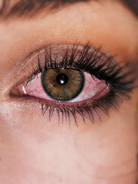 Alcoholic Eyes, Eye Veins, Blood Shot Eyes, Zombie Oc, Bloodshot Eyes, 17th Birthday Ideas, Irritated Eye, Red Veins, Eye Illustration