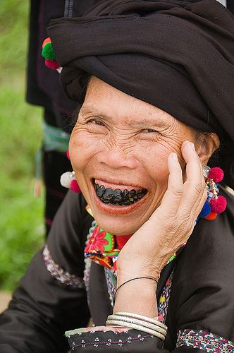 The Black Teeth Of A Black Lu Hilltribe Woman In Tam Duong Vietnam Black Teeth, We Are The World, Many Faces, White Teeth, Body Modifications, People Of The World, World Cultures, Happy Face, Smile Face