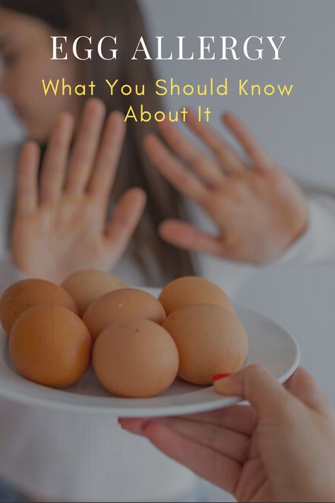 The egg allergy is one of the most common food allergies in children. Here you can find out the causes, the symptoms and what can help. Egg Allergy Recipes Kids, Gluten Allergy Symptoms Signs, Egg Allergy Symptoms, Egg Allergy Recipes, Food Allergy Symptoms, Corn Allergy, Allergy Eyes, Natural Allergy Relief, Common Food Allergies