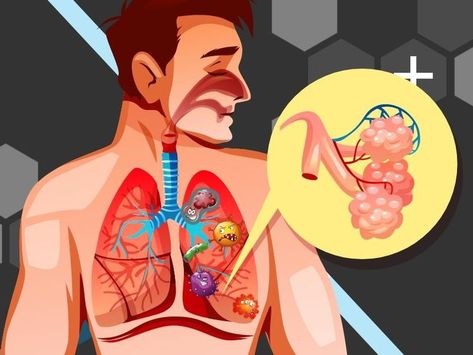 Respiratory Tract infections cover a wide variety of symptoms that brings discomfort to your ability to breathe. It can be something mild or can be a sign of something more severe. Failure to treat it quickly can cause other underlying conditions. https://www.facebook.com/rx2gopharmacy/posts/pfbid02GGzv9fA8aWka1nyXxgEa5dBf4cGMyN8eU3ZzRSkx2EARxmFkouuJCHUDSvSmhQqml #RTI #lungs #respiratorytractinfection #cough Health Podcast, Medical Facts, Respiratory Infection, Feminine Health, School Of Medicine, Health Matters, Lungs, Health And Fitness Tips, Respiratory