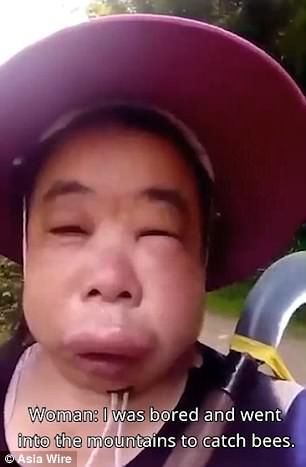 A woman in China who was stung by a swarm of bees recorded her hilarious reaction after he... Bee Stung Lips, Swarm Of Bees, Swollen Face, Women In China, Being Smart, Kid Logic, Bee Swarm, Left Eye, Bee Sting