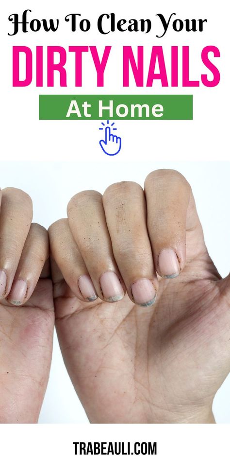 How To clean Your Dirty Nail How To Whiten Nails, Nail At Home, Dirty Nails, Dark Color Nails, Stained Nails, Nail Discoloration, Good Nails, Nail Remedies, Nail Polish Stain