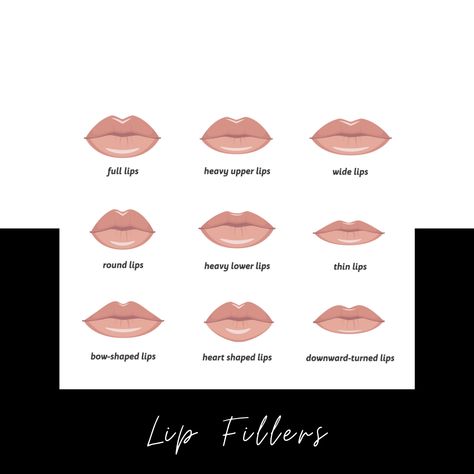 Post Fillers, Lip Filler Shape Ideas, Elite Aesthetics, Lips Inspiration, Shape Ideas, Hyaluronic Acid Fillers, Anti Wrinkle Injections, Cheek Fillers, Lip Augmentation