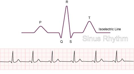 THIS IS A NORMAL HEART RHYTHM. I've come across so many people with random heart rhythms, like AV Blocks and other arrhythmias, as tattoos, and it makes me cringe. I love the idea, just please try to get the right one :) The above is a sinus rhythm, which is the normal (and healthy) rhythm for the heart. Ekg Tattoo Memorial, Learning Division, Function Of The Heart, Emt Life, Ekg Tattoo, Sinus Rhythm, Tattoo Memorial, Normal Sinus Rhythm, Ems Humor