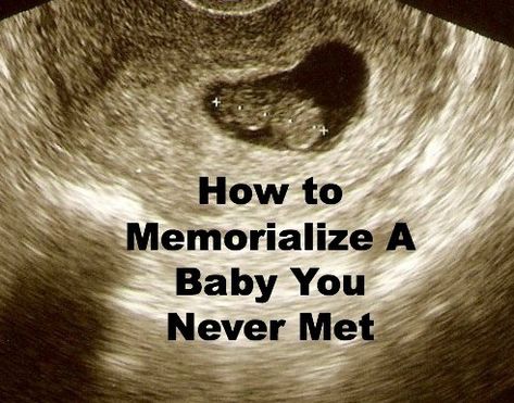 If you're looking for a way to memorialize a baby you never met, this post provides a really neat idea. A beautiful way to remember a miscarried baby. Unborn Baby Quotes, Remembering Baby, Angel Baby Quotes, Baby Memorial Tattoos, Baby Remembrance, Losing A Baby, Unborn Baby, Pregnancy Loss, Baby Tattoos