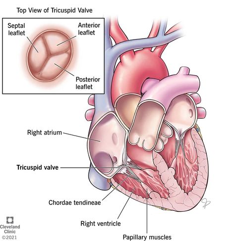 Enlarged Liver, Tricuspid Valve, Heart Valves, Heart Defect, Heart Pump, Heart Function, Heart Muscle, Body Fluid, Cleveland Clinic