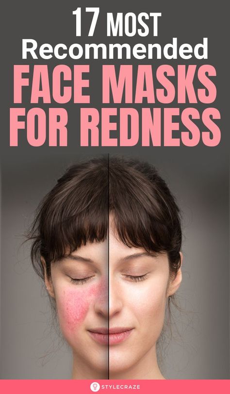 17 Most Recommended Face Masks For Redness: Anti-acne or anti-redness face masks come with soothing anti-inflammatory ingredients. Using them regularly unclogs pores, protects the skin from pollutants and keeps it even-toned. #beauty #beautyhacks #facemask #skincare Redness Face, Face Mask For Redness, Facemask Skincare, Funny Optical Illusions, Acne Redness, Homemade Facial Mask, Best Face Masks, Anti Redness, Perfectly Timed Photos