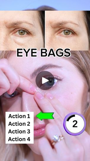 Eye Bag Cream, Face Fitness, Exercise Daily, Nail Soak, Face Exercises, Face Makeup Tutorial, Yoga Facial, I Call You, Face Massage