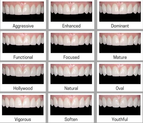 Long Canines Teeth Human, Different Teeth Shapes, Types Of Teeth Shapes, Hygiene Gift Basket, Hygienic Tips, Body Hygiene Products, Aesthetic Teeth, School Hygiene, Perfect Teeth Smile