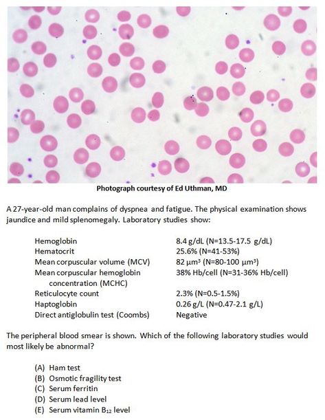 Hereditary Spherocytosis, Question Of The Week, Physical Examination, Exam Prep, 27 Years Old, Abdominal Pain, Best Answer, Doctor Medical, Old Men