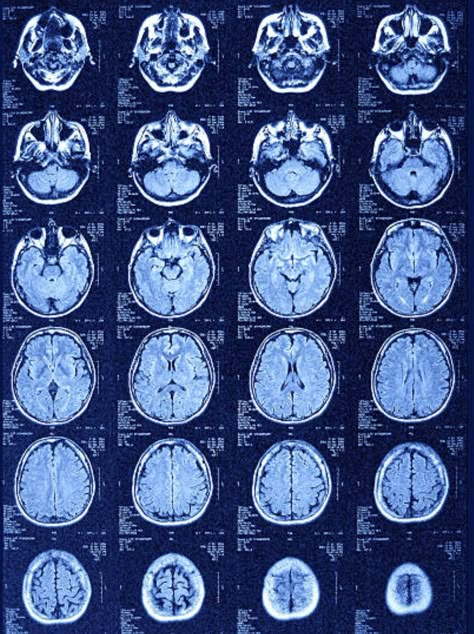 Computational Neuroscience, Neuroscience Aesthetic, Pep Guardiola Style, Stem Girl, Md Aesthetic, December Reading, Mri Tech, Neuroscience Art, Comp Sci