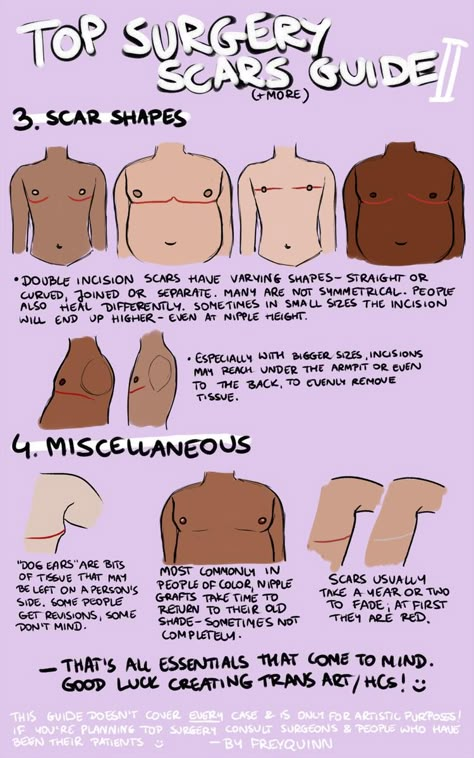 Top Surgery Scars, Top Surgery, Trans Art, Trans Boys, Losing 40 Pounds, Cold Sores Remedies, Lose 40 Pounds, Body Reference, Drawing Poses