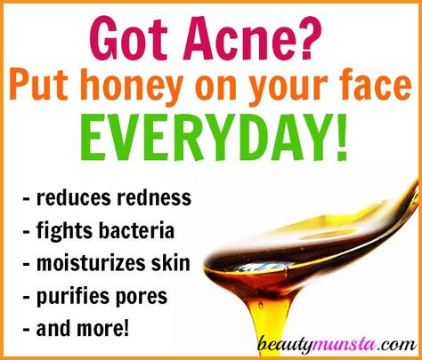 Learn how to use manuka honey for acne on your face everyday! Painful Pimple, Honey For Acne, Beauty Diy Skincare, Good Healthy Snacks, Manuka Honey, Happy Skin, Beauty Hacks Video, Natural Health Remedies, Natural Beauty Tips