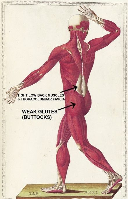 Lower Crossed Syndrome: What is it, Why is it a Problem, and How You Should be Addressing it. Psoas Muscle Pain, Mid Back Pain, Hip Flexor Exercises, Bursitis Hip, Hip Pain Relief, Chronic Lower Back Pain, Sciatica Exercises, Back Stretches For Pain, Lower Back Pain Exercises