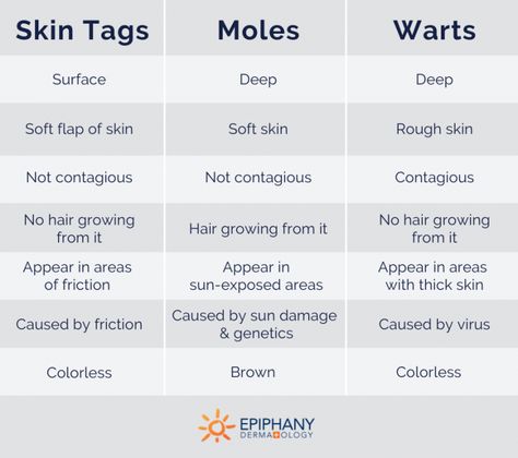 How to Tell the Difference Between Skin Tags, Moles, & Warts Remove Warts, Mole Removal, Lip Care Routine, Skin Tags, Word Online, Thick Skin, Creating A Newsletter, Rough Skin, Medical Information