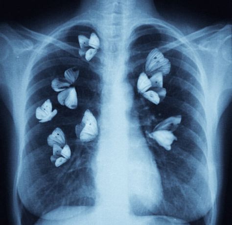 Xray Art, Image Swag, Meaningful Drawings, Lungs, X Ray, الرسومات اللطيفة, Blue Aesthetic, Pretty Pictures, Pretty Wallpapers