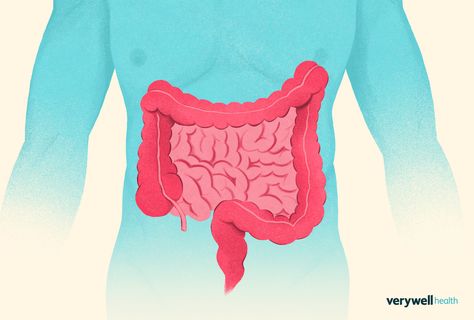 The sigmoid colon normally helps stool transit out the last part of the large intestine. This article describes functional impairments and pain symptoms. Tortuous Colon Diet, Colon Problems, Rectal Prolapse, Sigmoid Colon, Abdominal Discomfort, Healthy Morning Routine, Irritable Bowel, Health Habits, Abdominal Pain