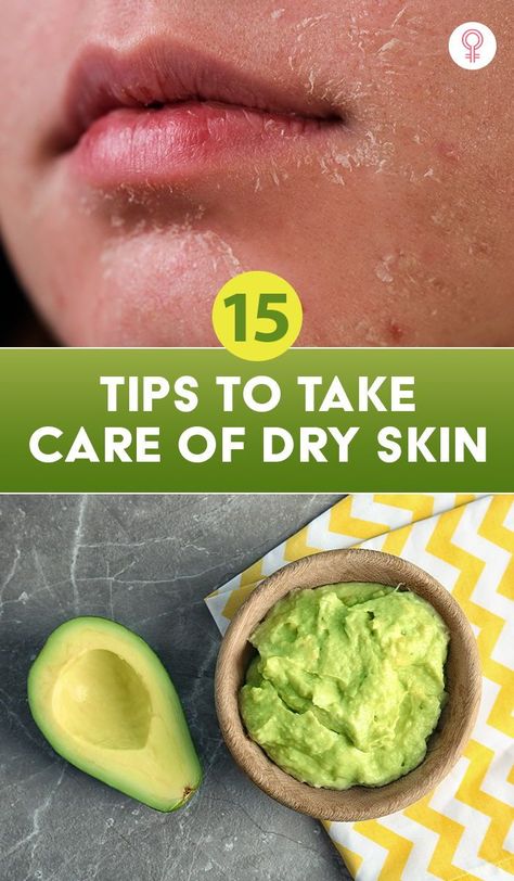 Flaky Skin On Face, Dry Skin Home Remedies, Dry Patchy Skin, Dry Peeling Skin, Dry Skin Diy, Patchy Skin, Super Dry Skin, Facial For Dry Skin, Dry Skin Care Routine