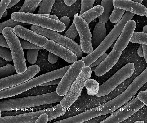 Kingdom Monera: unicellular organisms without a nucleus; includes Domains: Bacteria & Archaea Tighten Skin, Gut Flora, Gut Bacteria, Nanotechnology, Chronic Fatigue, Fermented Foods, Microbiology, Skin Tightening, Kombucha