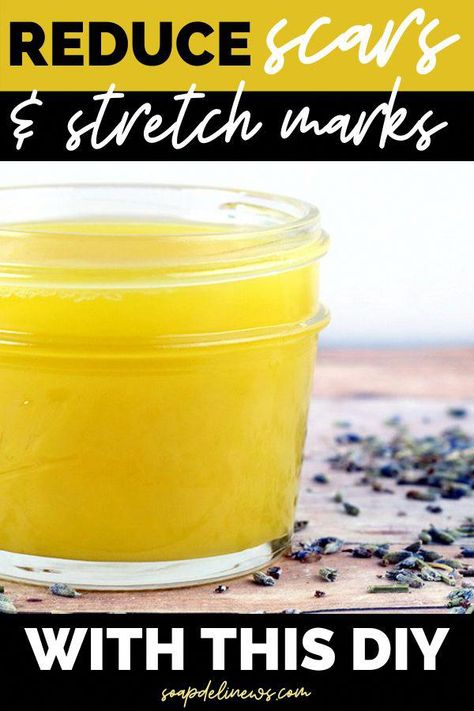 #NaturalSleepRemedies Homemade Salve Recipes, Get Rid Of Scars, Getting Rid Of Scars, Stretch Mark Remedies, Wrinkle Skin Care, Cold Sore Remedies, Salve Recipes, Remedies For Cough, Losing 40 Pounds