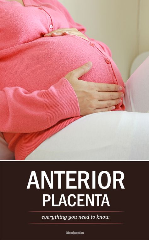 Anterior Placenta - Everything You Need To Know 20 Weeks Pregnant Belly, Anterior Placenta, Pregnancy Delivery, Pregnancy Stretches, Natural Labor, Doula Business, Pregnancy Info, Pregnancy Labor, Birthday Quotes Funny For Him