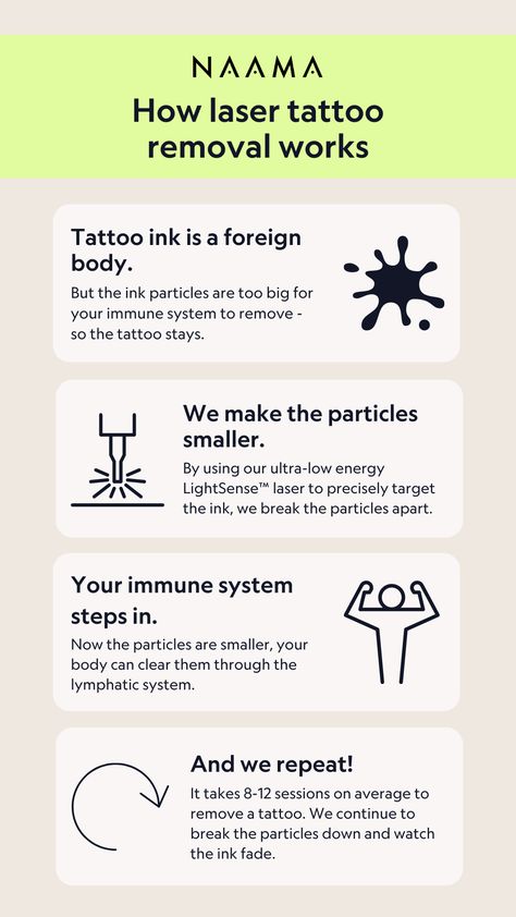 Four-step sheet explains the laser tattoo removal process. Laser Tattoo Removal Process, Removing Tattoos, Tatto Designs, Laser Removal, Laser Tattoo, Laser Tattoo Removal, Instant Messaging, Tattoo Removal, Low Energy