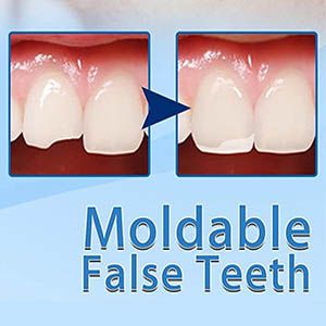 Chipped Tooth Repair, Denture Repairs, Chipped Tooth, Tooth Filling, Temporary Tooth, Tooth Repair, False Teeth, Fake Teeth, Tooth Replacement