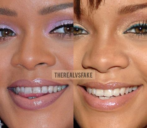 Nose Fillers, Rihanna Beyonce, Filters Instagram, Digital Computer, Photoshop Filters, Nose Surgery, Foreign Language Learning, Tv Radio, Janet Jackson