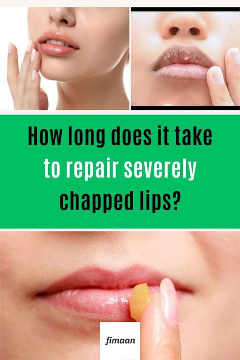 Tired of dealing with painfully cracked, flaky lips? Unlock the keys to soft, supple lips with these 5 expert-approved tips. Uncover the causes of chapped lips, learn gentle exfoliation techniques, and discover the best hydrating ingredients to seal in moisture. Say goodbye to chapped pouts for good with this comprehensive lip care guide. #LipCare #CrackedLips #DrySkin #LipExfoliation #LipHydration #SkincareTips #BeautyHacks #SkinGoals Lip Care Tips, Lip Masks, Dry Cracked Lips, Supple Skin, Lip Exfoliator, Cracked Lips, Lip Hydration, Chapped Lips, Gentle Exfoliator