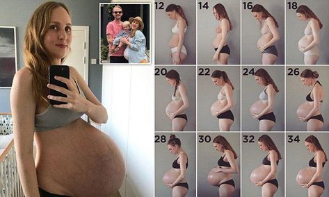 Mother pregnant with TRIPLETS shares extraordinary week-by-week photos Triplet Baby Bump, Twin Belly Progression, Twin Bump Progression, 3 Month Baby Bump, 30 Weeks Pregnant Belly, Pregnant With Triplets Belly, 3 Months Pregnant Belly, 4 Months Pregnant Belly, Triplet Pregnancy