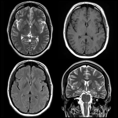 Mri Scan Aesthetic, Fmri Scans, Ct Scan Brain, Brain Mri Scan, Anatomy Embroidery, Brain Mri, Depersonalization Disorder, Medical Reference, Brain Pictures