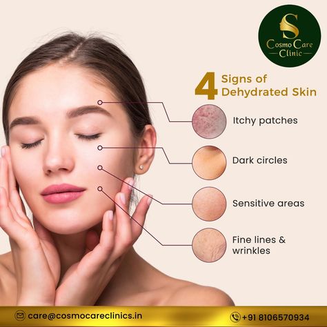 Not sure if your skin is struggling with dehydration? Well here are 4 signs which show that you have dehydrated skin!!! If your skin is showing these signs then cosmo care is here to help! Book your appointment and get a consultation before time runs out! Call Us :8106570934 #cosmocareclinic #skinwhiteningtreatment #skintreatmentent #beauty #beautyclinic #skin #hair #hyderabad Skin Care Center, Instagram Prints, Beauty Clinic, Cosmetic Skin Care, Dehydration, Itchy Skin, Book Your Appointment, Dehydrated Skin, Creative Ads