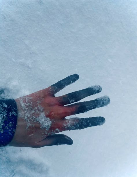 Frost bite on hand using alchol activated makeups. Ice On Face Aesthetic, Frostbitten Aesthetic, Neck Wound Makeup, Frostbite Hands, Frostbite Aesthetic, Freezing Aesthetic, Frost Bite Makeup, Jack Frost Aesthetic, Frostbite Makeup