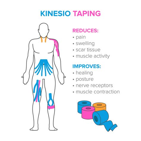 Kinesio Taping Knee, Physio Tape, K Tape, Kinesio Tape, Kt Tape, Sjogrens Syndrome, Kinesio Taping, Sports Therapy, Gym Workout Chart