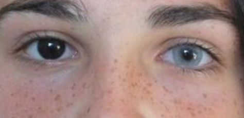 Heterochromia Eyes, Aesthetic Eyes, Pretty Eyes, Beautiful Eyes, Face Claims, Pose Reference, Eye Color, Character Inspiration, Pretty People