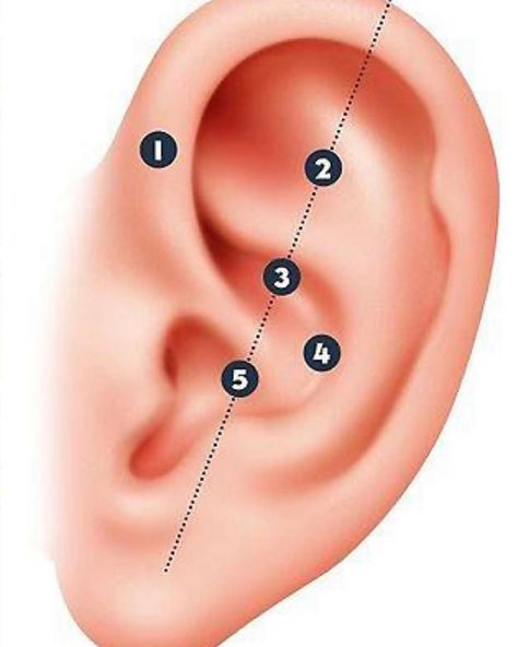 Rami AlOtaibi (@masaricare) posted on Instagram • Aug 3, 2020 at 6:55pm UTC Auricular Acupuncture, Ear Reflexology, Ear Acupuncture, Ear Seeds, Autonomic Nervous System, Acupuncture Points, Integrative Medicine, Acupressure Points, Traditional Chinese Medicine